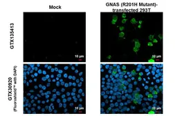 Anti-GNAS (R201H Mutant) antibody used in Immunocytochemistry/ Immunofluorescence (ICC/IF). GTX135413